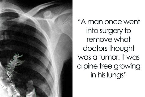 100 disturbing facts